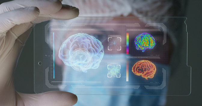 what is the hindbrain function